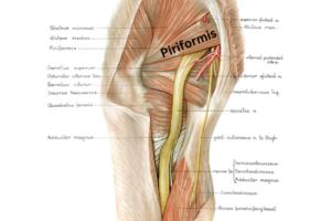Piriformis muscle pinching the sciatic nerve